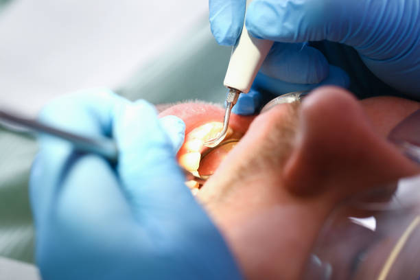 Best Emergency Dental Care for Broken or Chipped Teeth in Two Harbors, MN